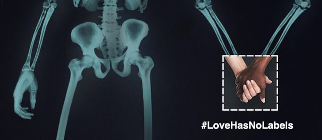 ‎LoveHasNoLabels